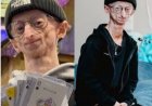   Belgische influencer Michiel Vandeweert (28) overleden na uitzonderlijk leven met progeria