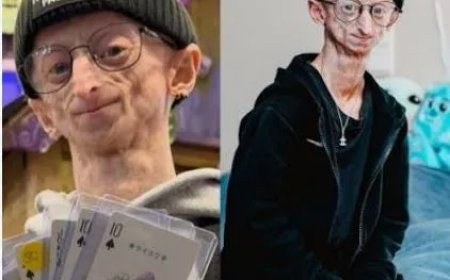  Belgische influencer Michiel Vandeweert (28) overleden na uitzonderlijk leven met progeria