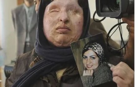 Ameneh Bahrami: het verhaal van een zuuraanval, vergelding en genade