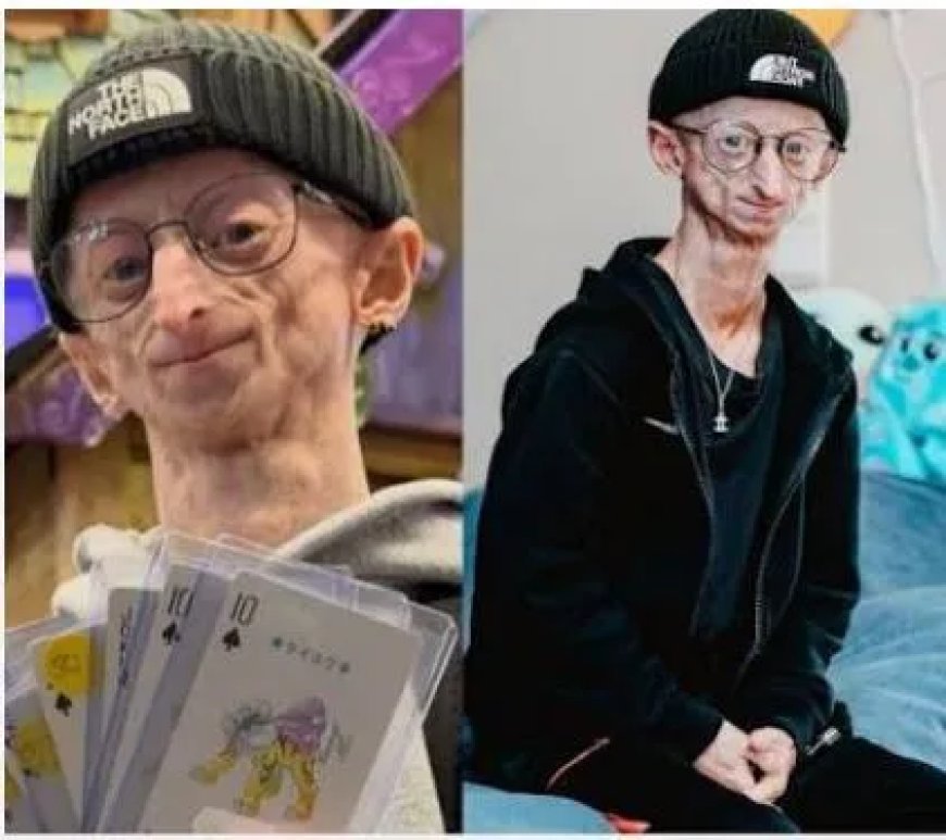   Belgische influencer Michiel Vandeweert (28) overleden na uitzonderlijk leven met progeria