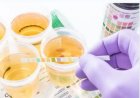 Bloed in urine altijd laten controleren