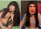 Schoonheidsinjectie verminkt gezicht Mexicaanse actrice