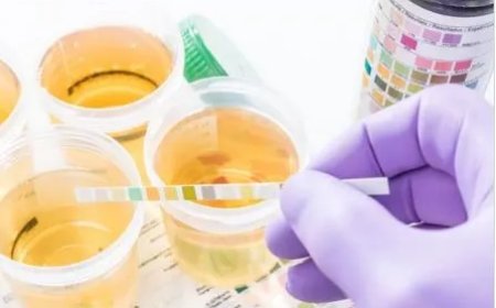 Bloed in urine altijd laten controleren
